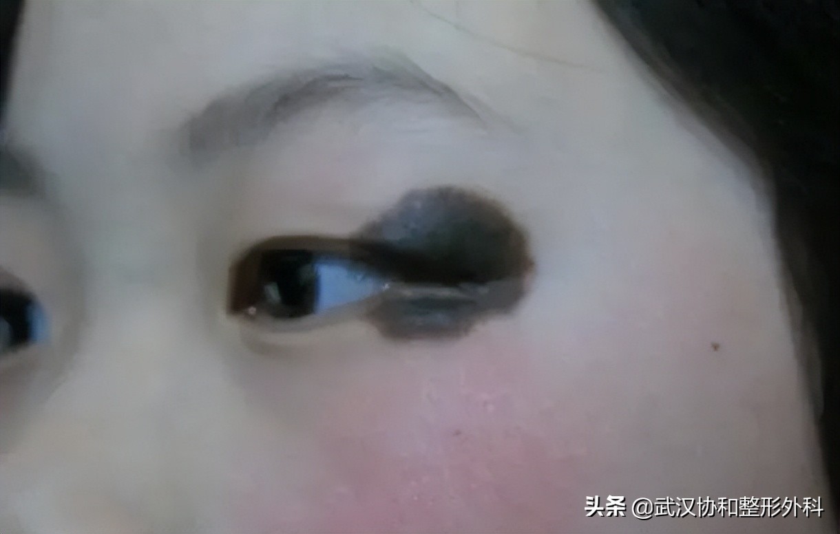 熊猫很漂亮但是很害羞,萌宝大熊猫的痣是天生的吗