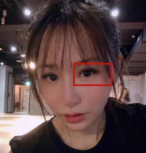 女子割双眼皮失败像瞪眼,女明星割双眼皮对比照