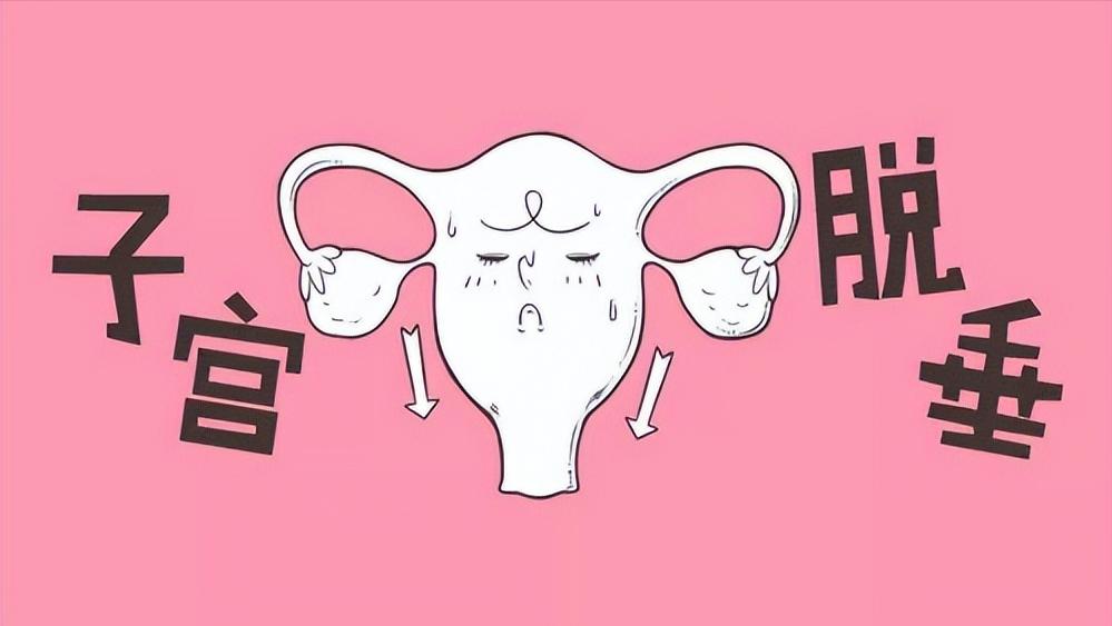 女人什么原因容易子宫脱垂,女人老了子宫脱落