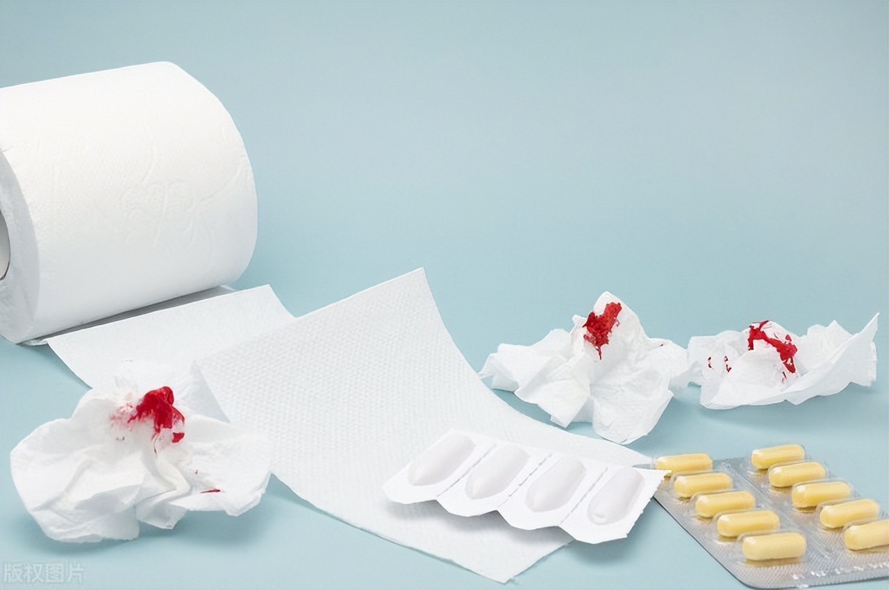 女性得肛裂有哪些危害呢,女性经常肛裂和痔疮怎么回事