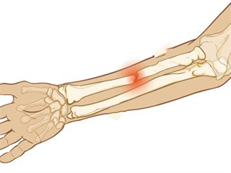 手臂疼痛的预兆是什么病,手臂突然疼痛难忍一般是什么原因