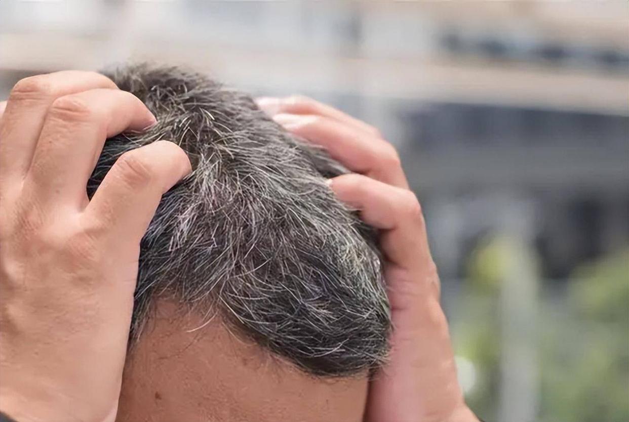 白发长在正头顶代表身体哪个器官,两鬓白发和后脑勺白发怎么治疗