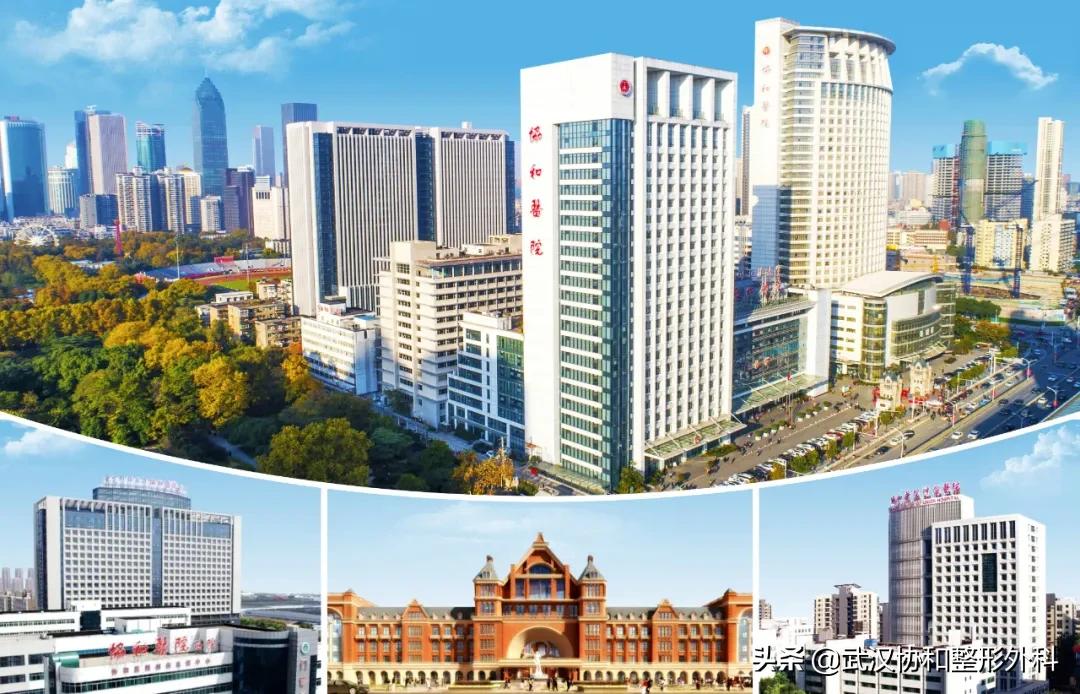 提眉术加开眼角,泡泡眼提眉术