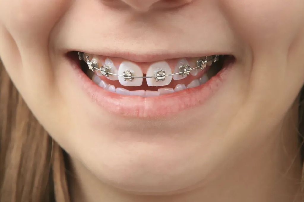 00后*款贷**整牙背后：牙医苦熬十年入百万，企业毛利高一年净赚上亿