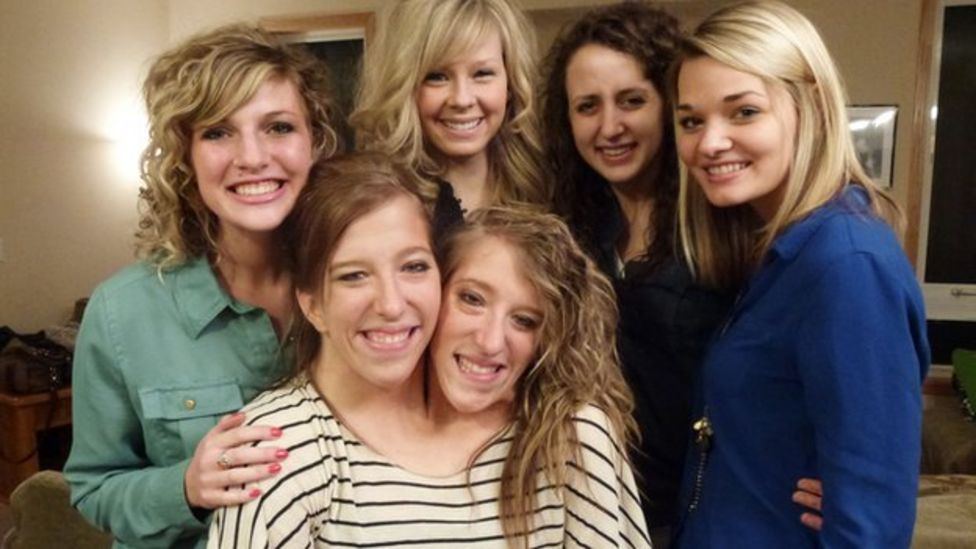 连体人是怎么诞生的,为什么会有雌雄连体人