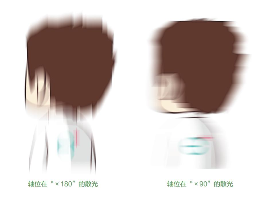 孩子散光还爱眯眼是什么情况,孩子老是眯眼是近视了么