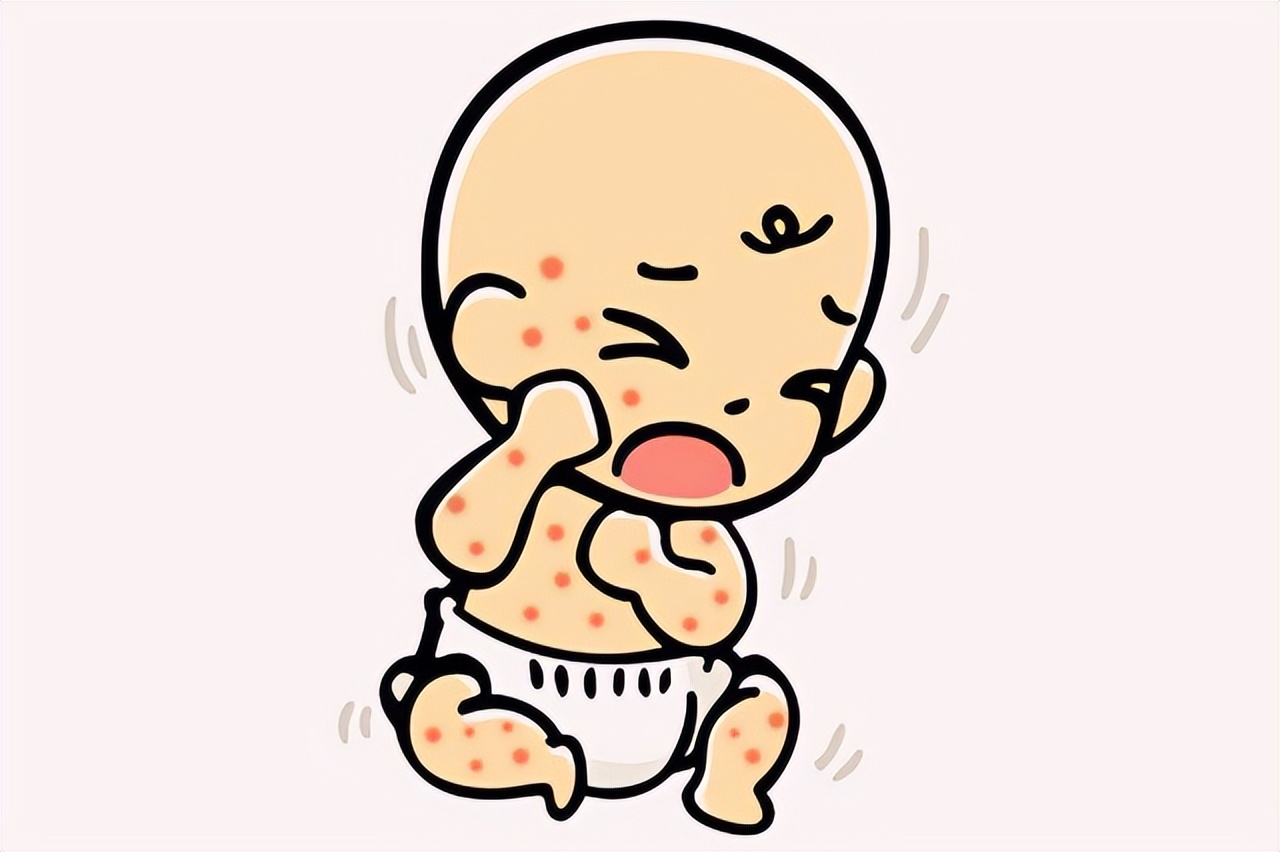 孩子淋雨起的疹子怎么办,小朋友淋雨