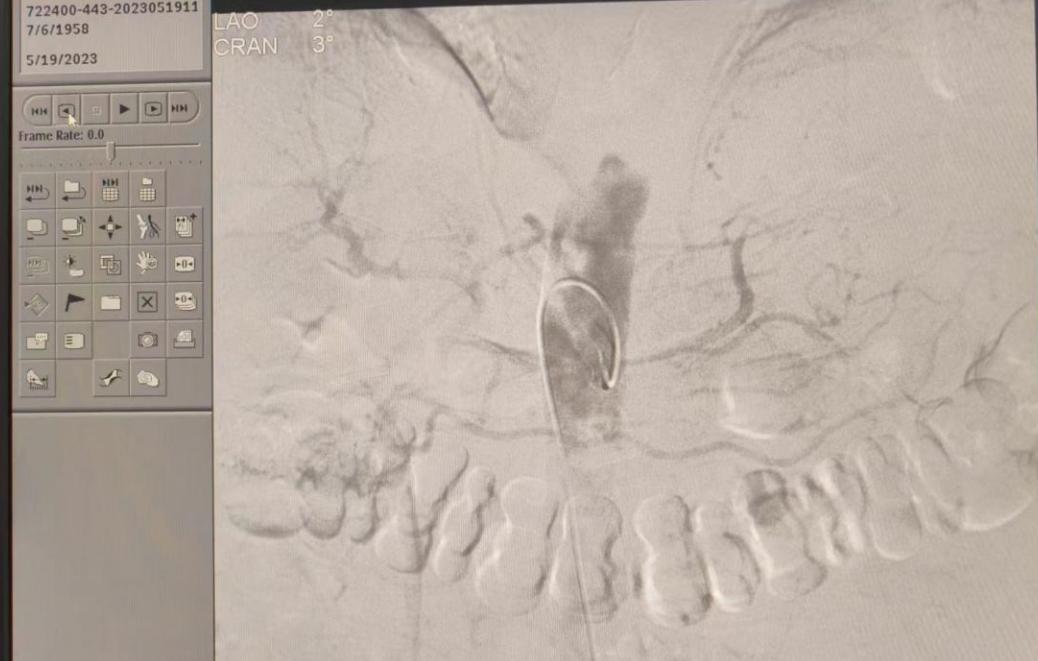 岳阳市湘岳医院,湖南省岳阳市湘岳医院