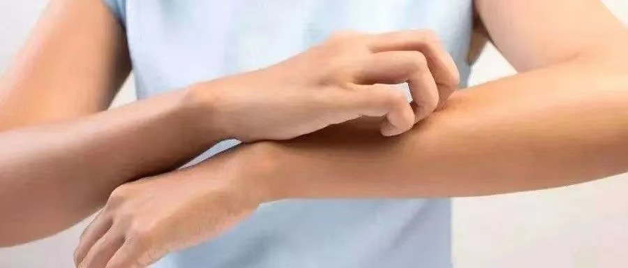 干痒症是什么引起的,身体哪些部位发痒是癌症的征兆