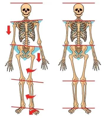 大脚趾外翻怎么治最好,大脚骨外翻走路疼痛怎么办