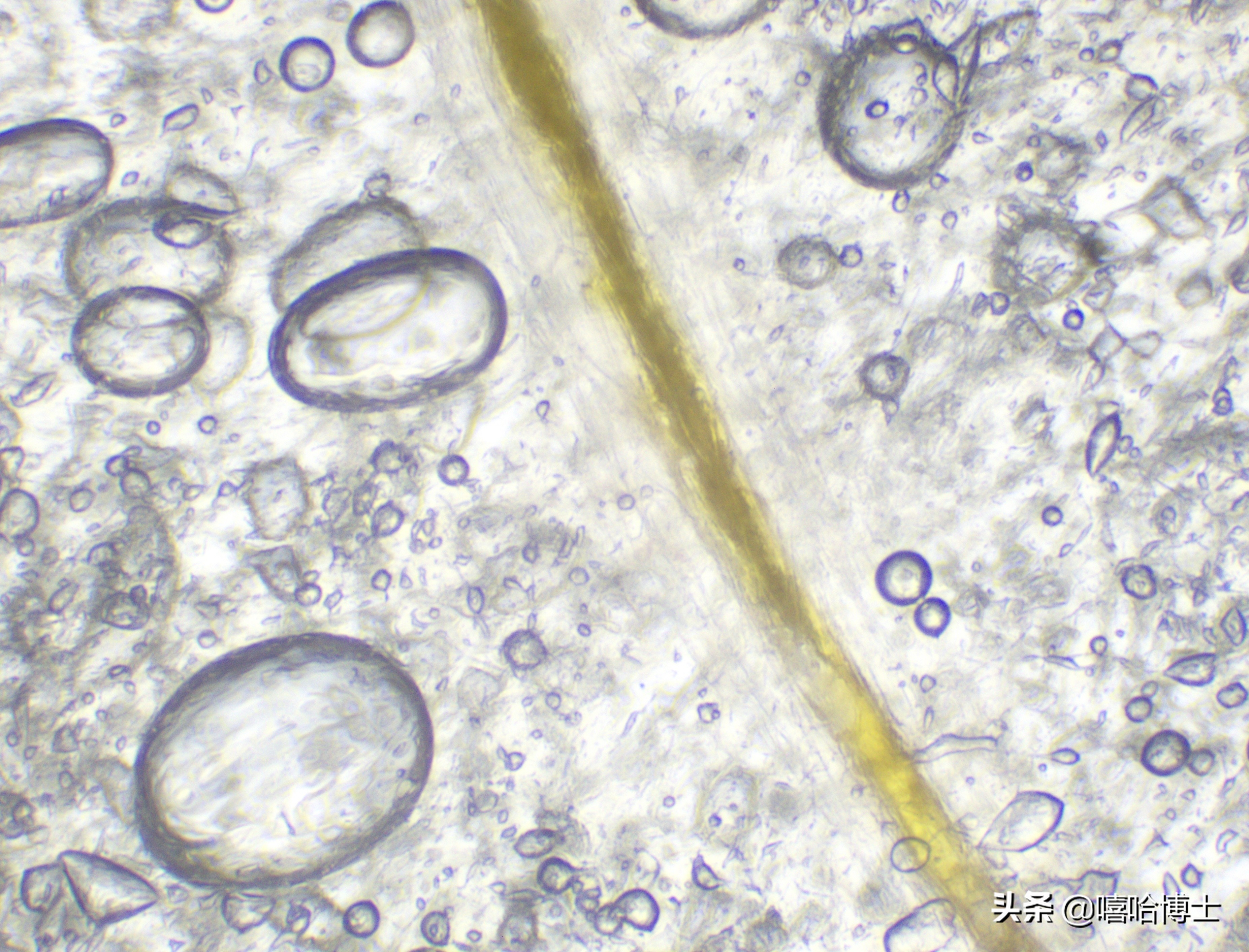 超级显微镜下的山竹,显微镜下的山竹果
