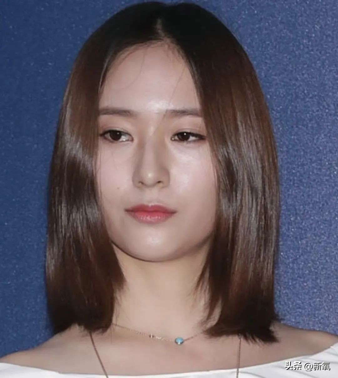 嘴唇薄变丰满,嘴唇变凸变丑怎么办