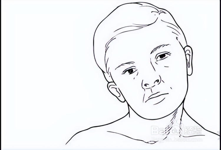 脖子歪斜很难受怎么办,脖子歪斜是什么原因造成的