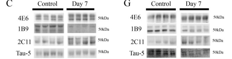 tau鎶椾綋,tau鎶椾綋涓村簥璇曢獙