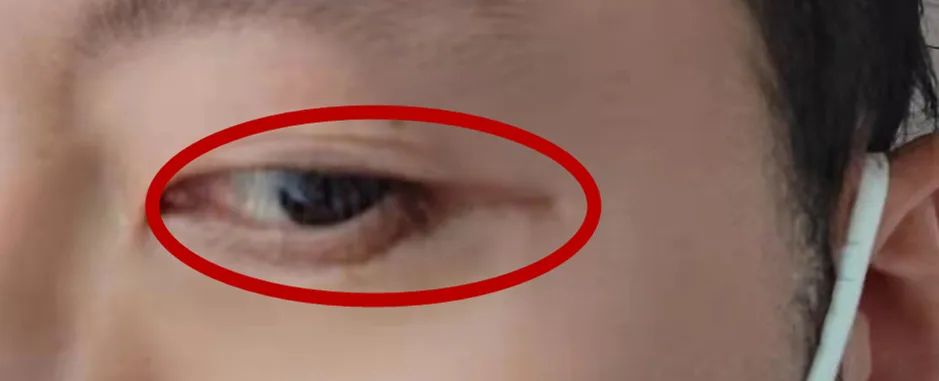 南京施尔美去疤痕,无锡施尔美整形祛疤痕