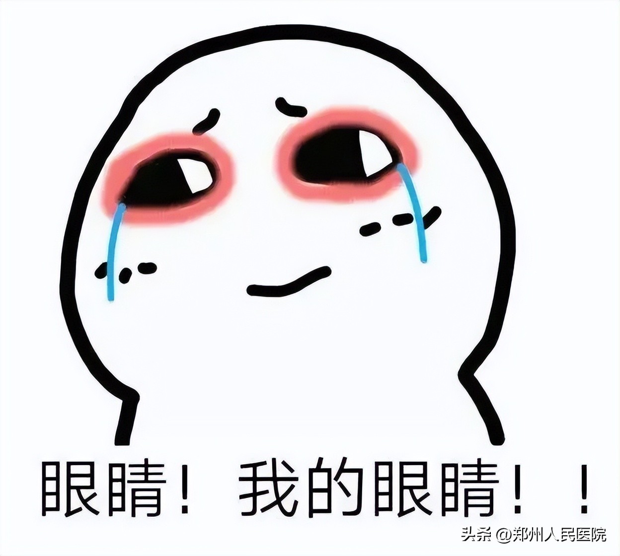 眼球突出恐怖图,眼球上长黄色凸起物怎么回事