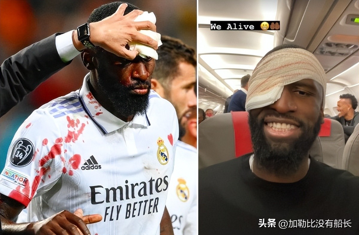 18年世界杯德国战车为什么惨败,德国战车vs比利时战车比赛