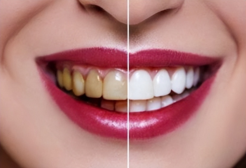 电动牙刷松下和飞利浦哪个好用,2023电动牙刷测评推荐自用