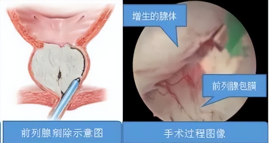河北省中医院男科专家门诊表,河北省人民医院泌尿外科怎样