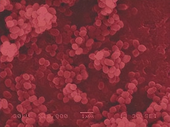 布鲁氏菌病最新治疗方法,布鲁氏菌病防治知识培训总结