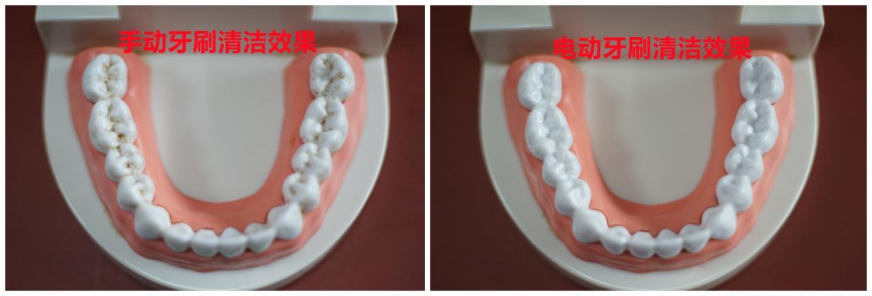 便宜电动牙刷有危害,电动牙刷对牙龈的危害