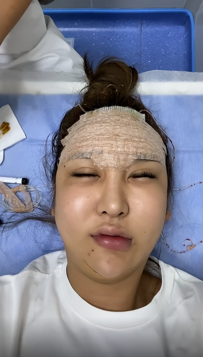 网红整容毁容真实案例,各大网红整容之后的后果