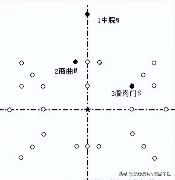 腹针疗法及16例常用处方