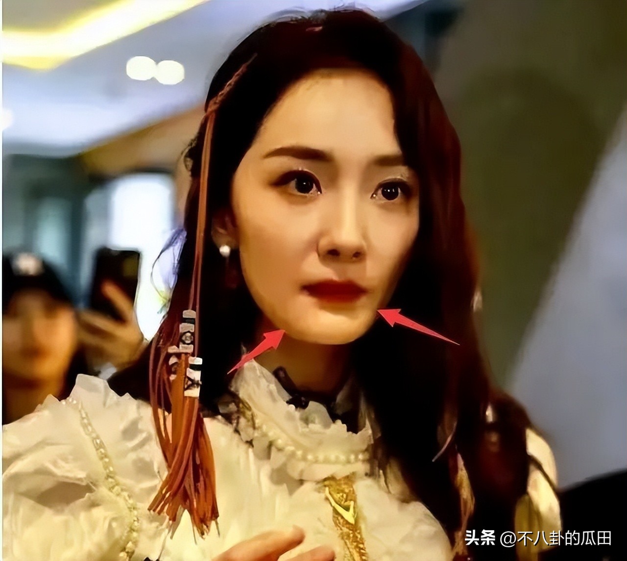 蔡徐坤下巴太尖惹争议图片,蔡徐坤下巴是假体吗