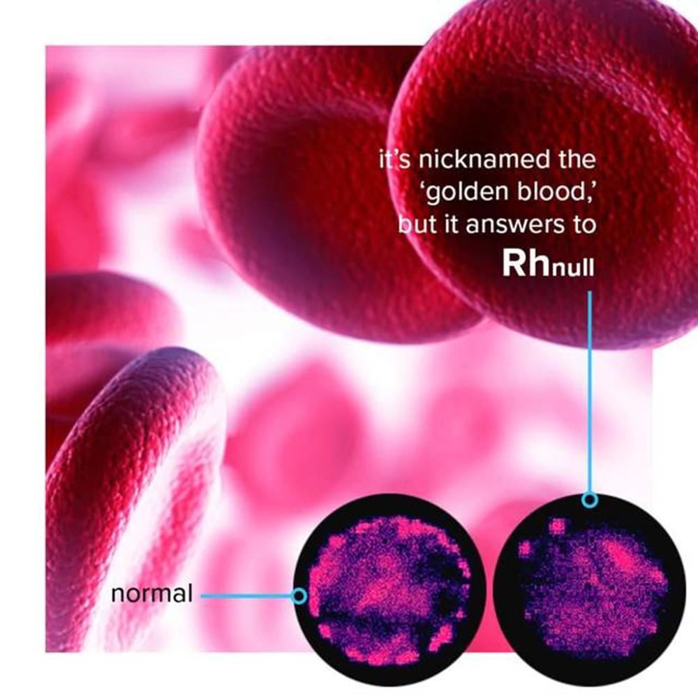 稀有血型熊猫血中的熊,什么血型比熊猫血稀有