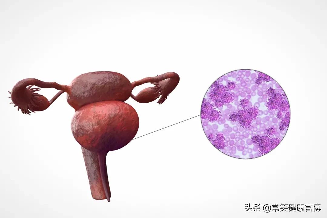 孕期出现蓝色白带怎么回事,孕期白带检查清洁度怎么看