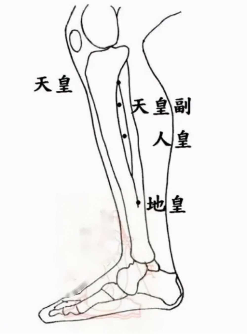 中医针灸泌尿系统疾病处方3