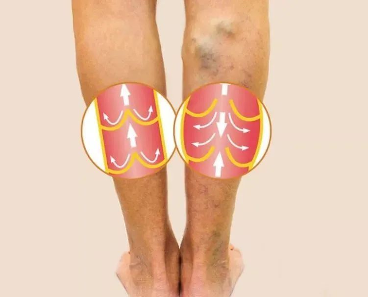 坚持与信仰：一对藏族夫妇7年，跨越2000公里的静脉曲张治疗之旅