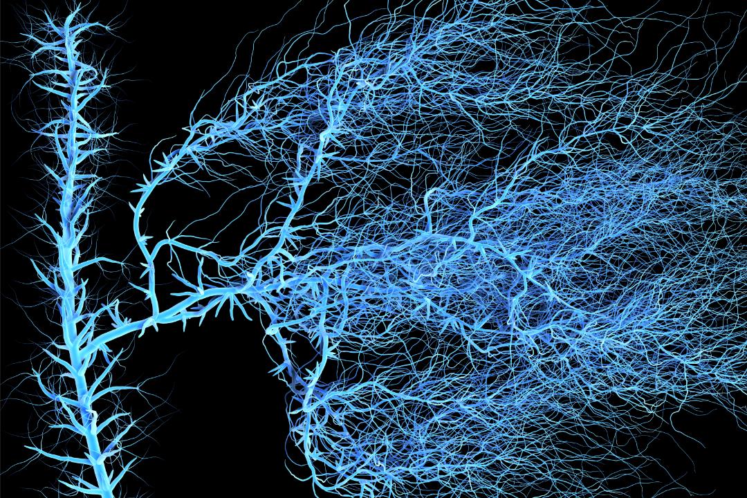 脑动静脉畸形介入手术风险,脑动静脉畸形无症状需要治疗吗