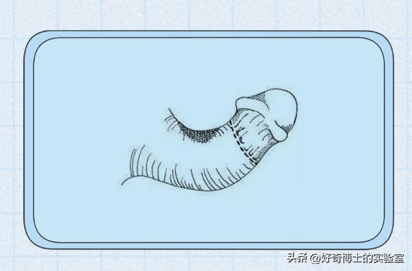 男生丁丁变歪是身体出了什么问题吗？影不影响*生活性**？