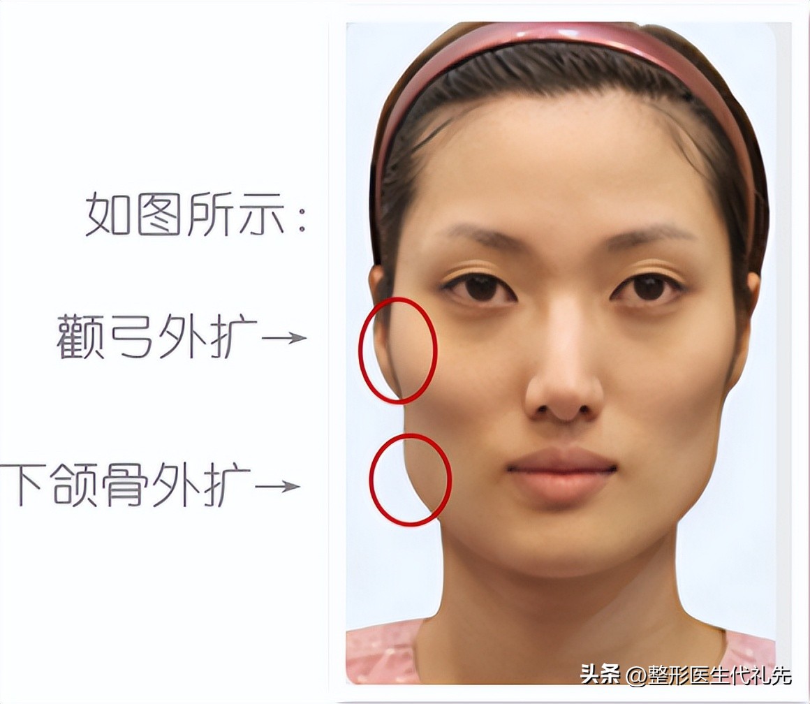 太阳穴凹陷怎么造成,太阳穴和脸颊突然凹陷的原因