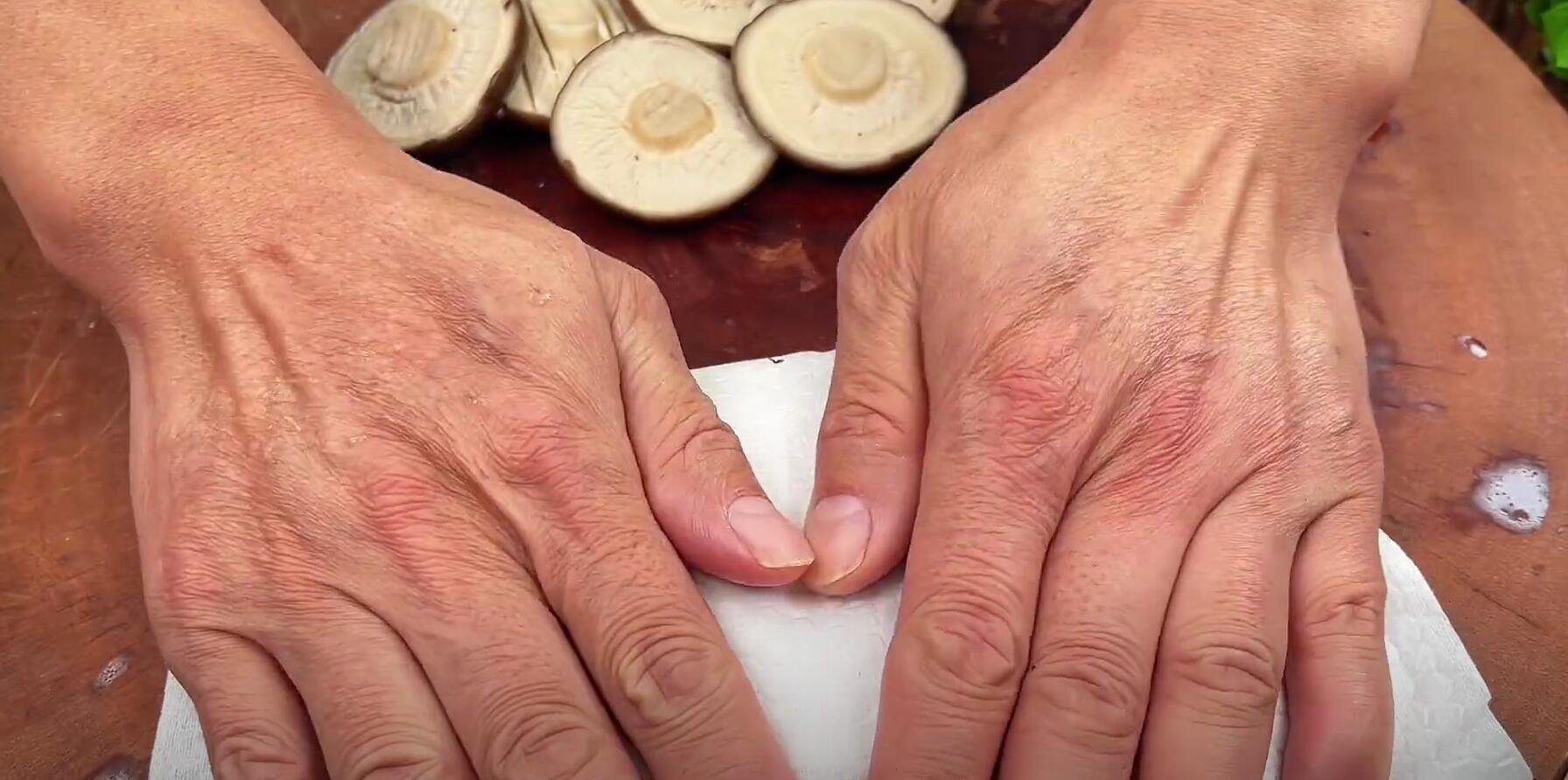 “阳了”要懂得忌口，建议少吃它，多吃这2样，增强免疫，身体棒