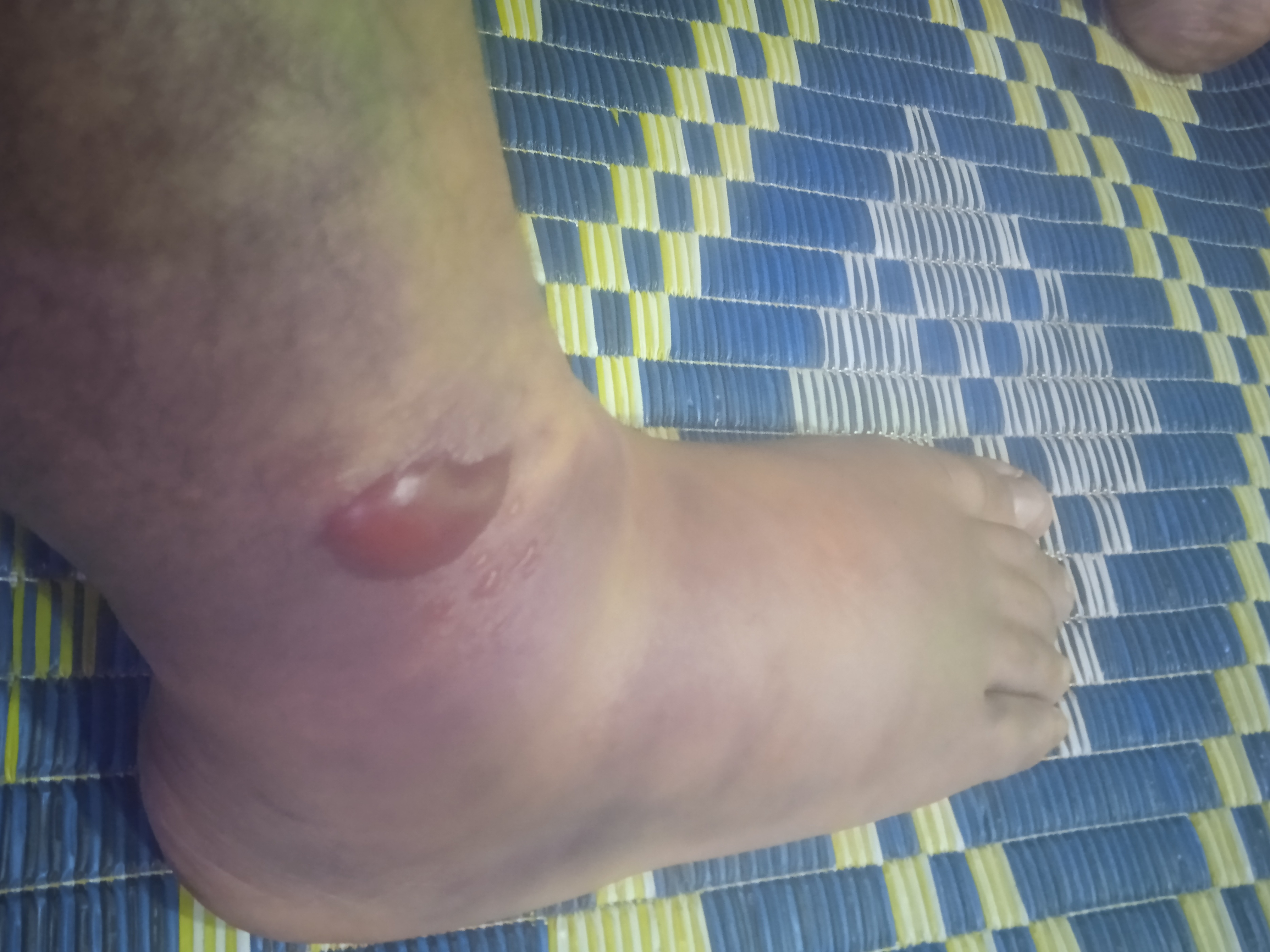 身家千万旅游公司老板被绑架到缅甸做诈骗，几经转手，暴瘦50斤；2022年最后一天称被保释，即将回家