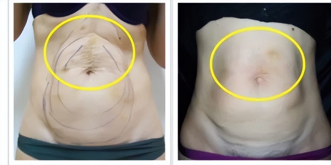 沈阳兰玉医美怎么样,盘锦兰玉医美