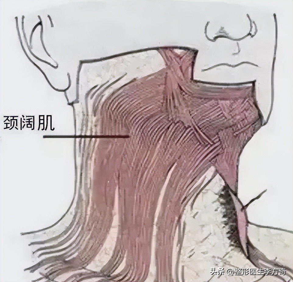 除皱针可提升面部吗,除皱针对面部的作用