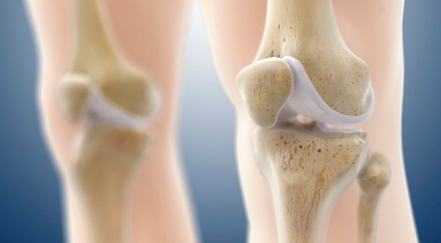 膝盖关节软骨疼痛怎么办,膝关节软骨疼痛的症状