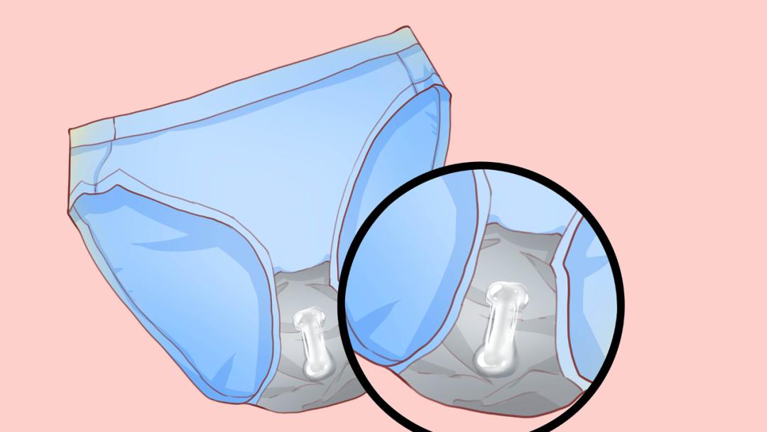 女朋友*裤内**总是湿湿的，但是她又不想要，是生病了吗？