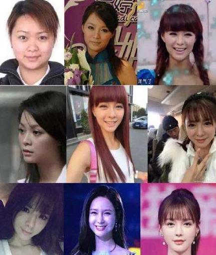 盘点整容失败惨不忍睹的30位女星,那些整容整失败的女明星
