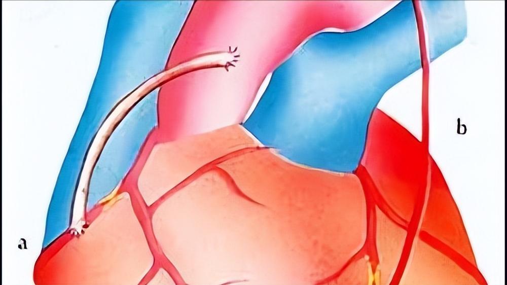 心脏跳动缓慢会影响睡眠吗,心脏跳动快慢和寿命长短有关系吗