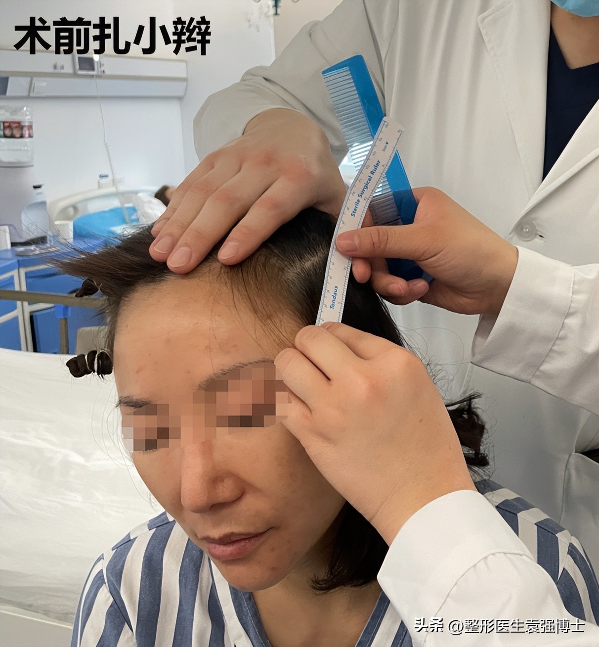 44岁女士拉皮除皱,50岁女人面部拉皮