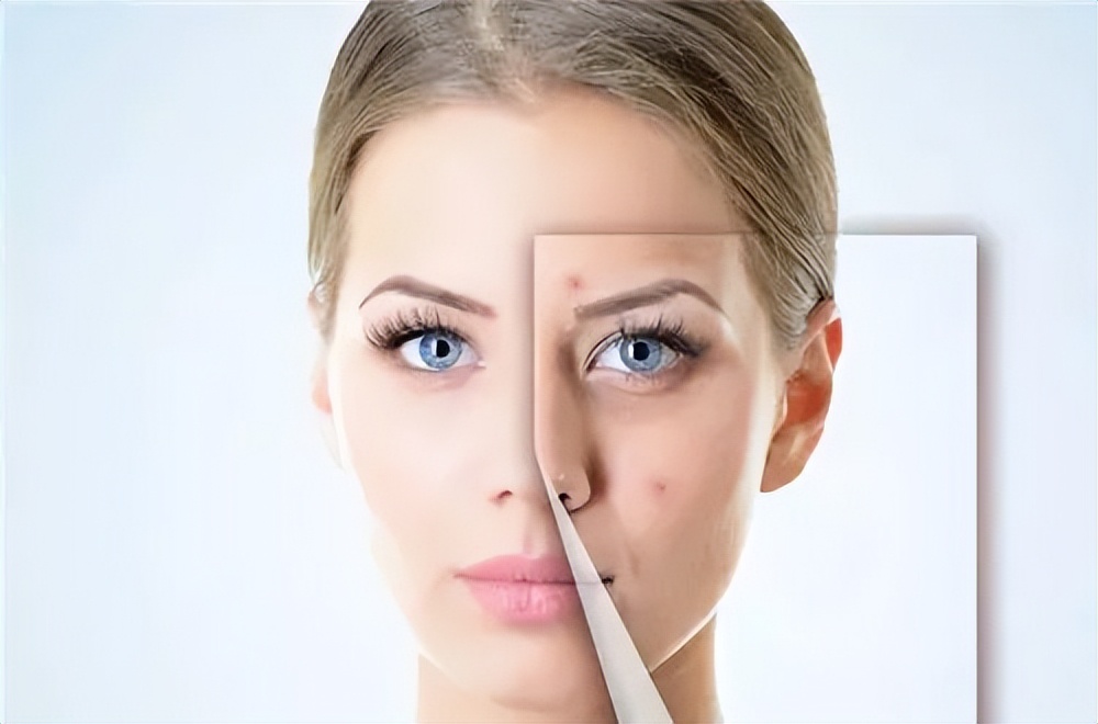 痘痘肌底妆怎么遮,新娘痘痘肌底妆服帖的方法