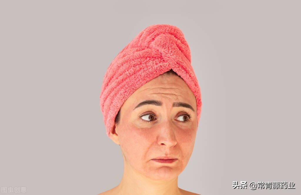 雀斑晒斑各种斑都是怎么形成的,色斑雀斑晒斑的区别