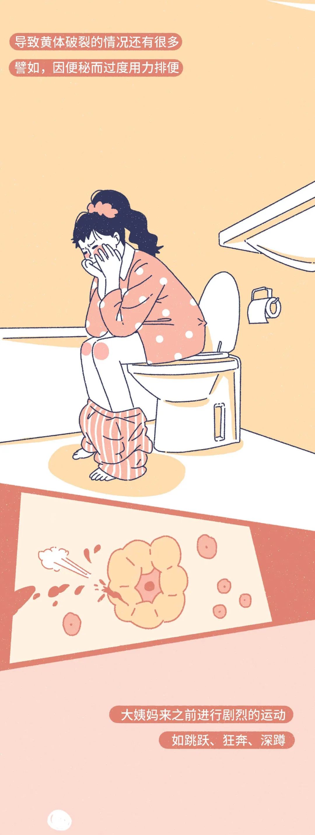 女生黄体破裂会是什么表现,什么原因会导致女性黄体破裂