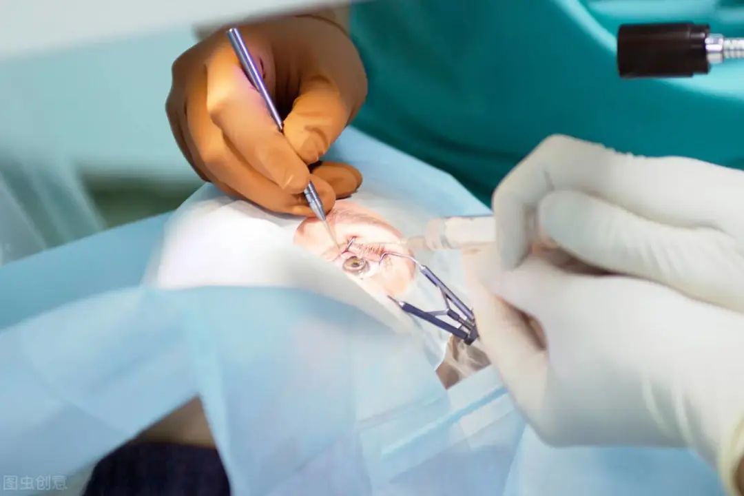 为什么有些人睡觉半睁着眼睛,为啥有些人睡觉半睁眼