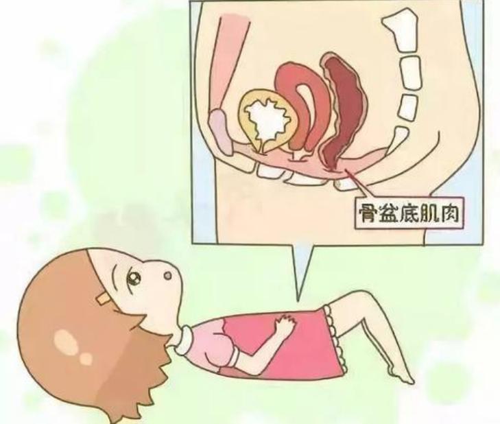 门肌训练,盆底肌医学讲解