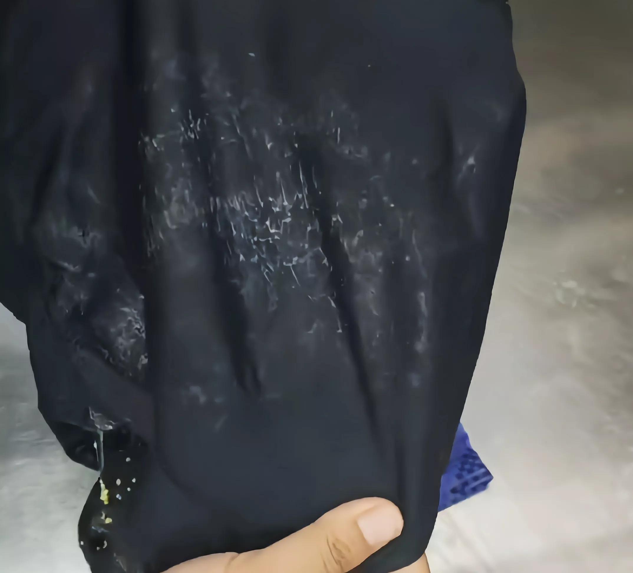 风油精真的能擦掉皮具上的胶印吗,风油精真的可以去除皮包上的污渍